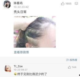 秃崽被爆料视频在线观看,揭秘背后惊人真相  第2张 秃崽被爆料视频在线观看,揭秘背后惊人真相  第2张